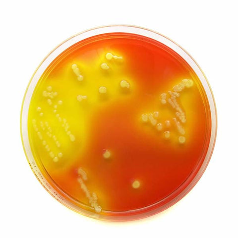 Bacteria in a petri dish